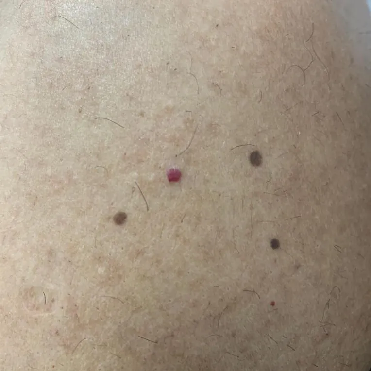 Puntos de rubí en Valencia. Entrada de cliente
