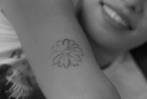 Andrea Garte elimina sus tatuajes en Everglow Skin Valencia