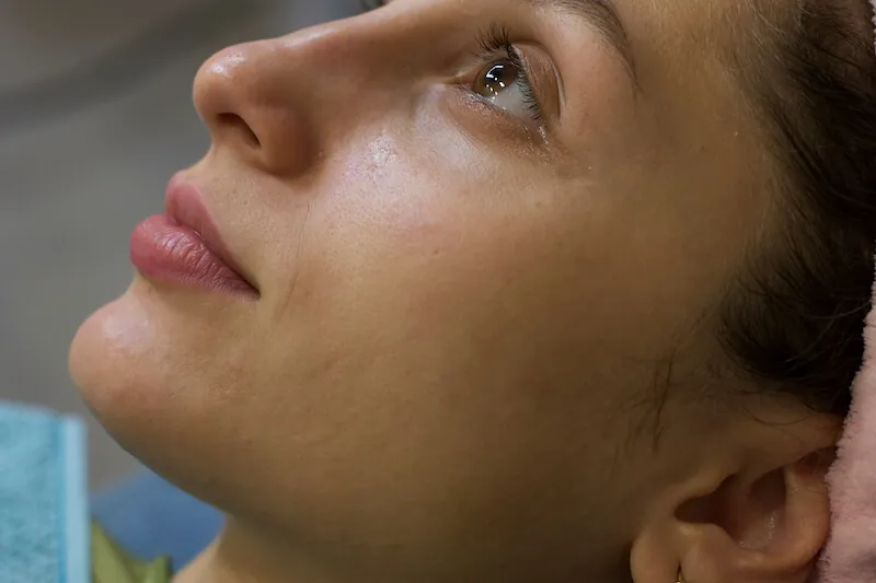 Limpieza de poros facial