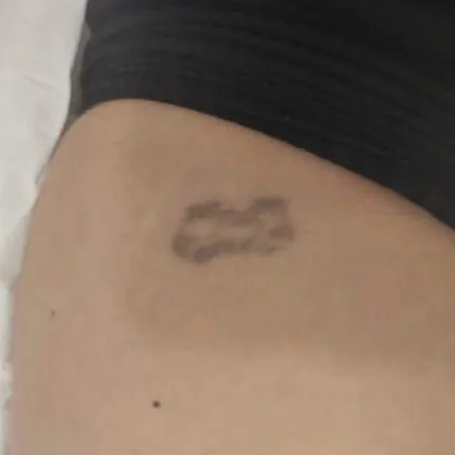 Tatuaje Andrea Garte Quinta sesión Mickey