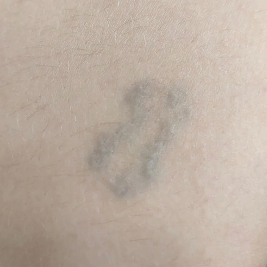 Sexta sesión tatuaje Andrea Garte