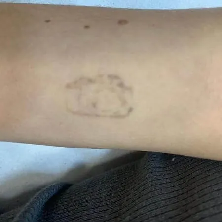Tercera sesión tatuajes Andrea Garte - Cámara de fotos