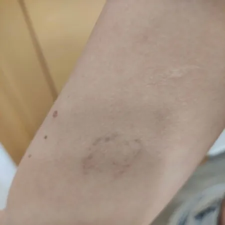Tatuaje Andrea Garte -sexta sesión brazo