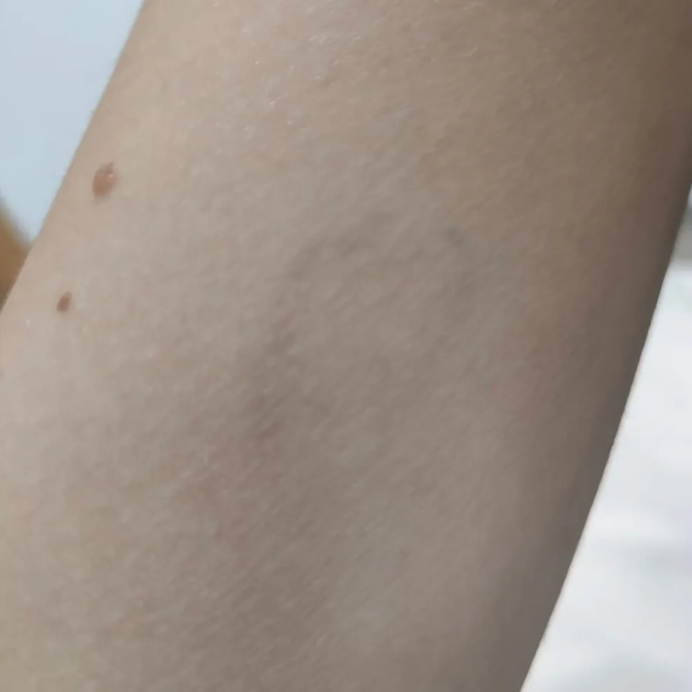 7a sesión tatuaje fotografía
