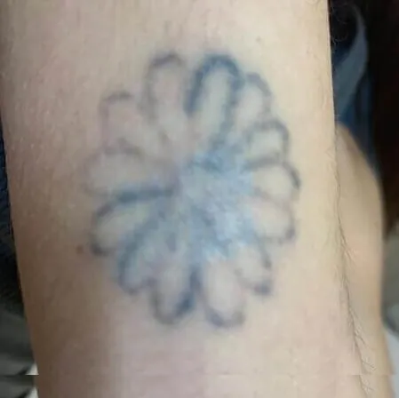Tatuaje Flor Andrea Garte - Tercera sesión