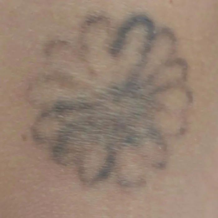Tatuaje Flor - quinta sesión - Andrea Garte