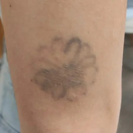 Tattoo Flor - sexta sesión - Andrea Garte