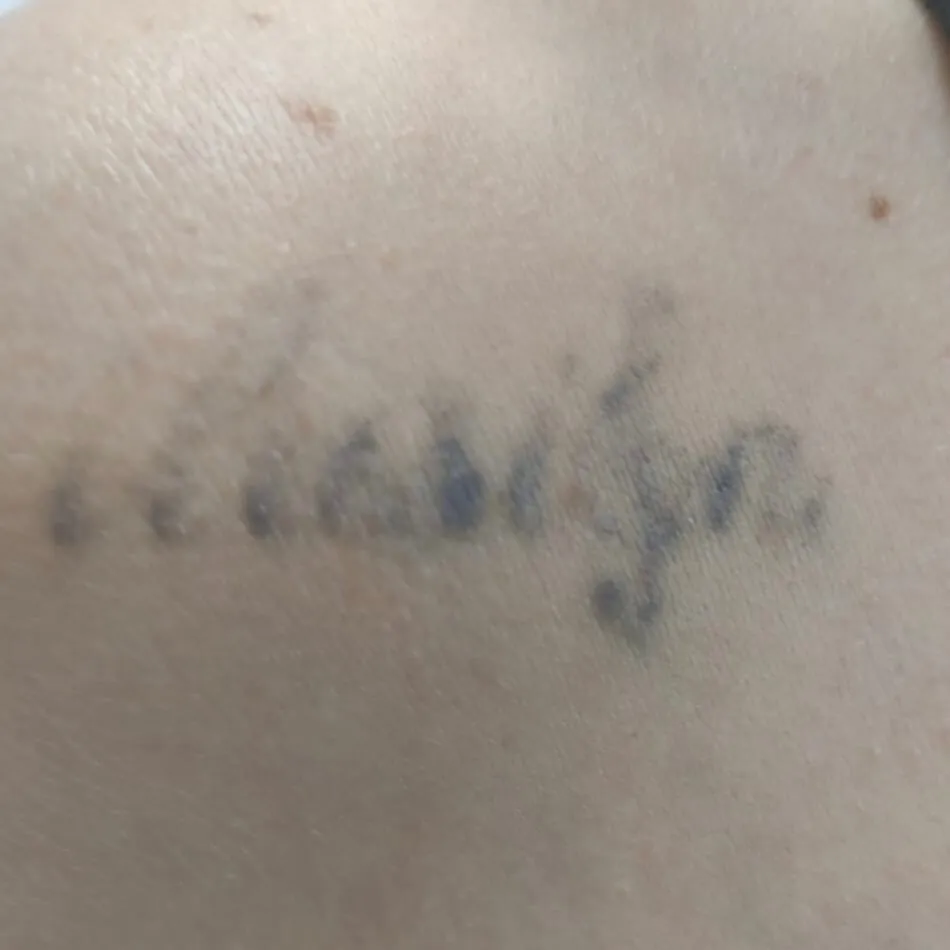 Quinta sesión tatuaje Andrea Garte