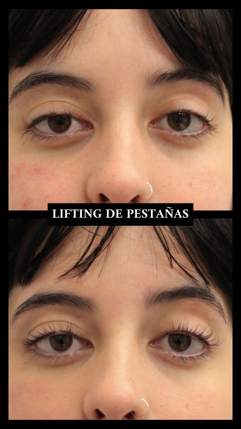 Lifting de pestañas antes y después | Everglowskin Valencia