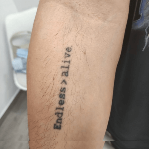 Eliminación de tattoo en antebrazo de ByViruzz en Valencia