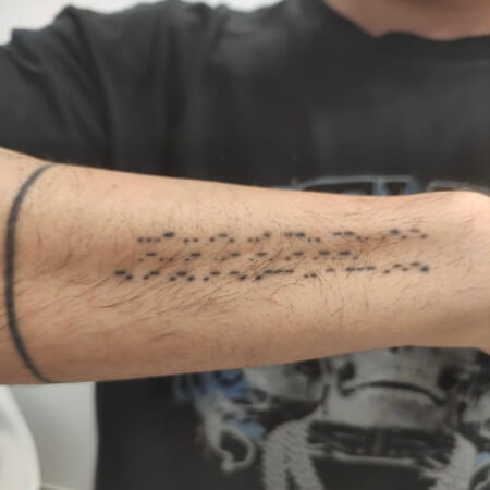 Eliminación de tatuajes en antebrazo de ByViruzz en Valencia