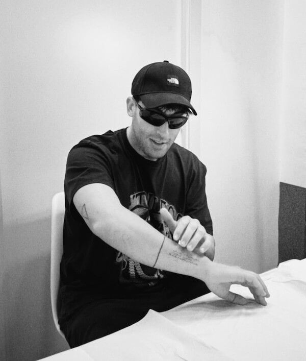 Eliminación de tatuajes de Victor Melida @byviruzz en Valencia