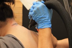 Todo lo que necesitas saber de cuanto duele eliminarse un tatuaje